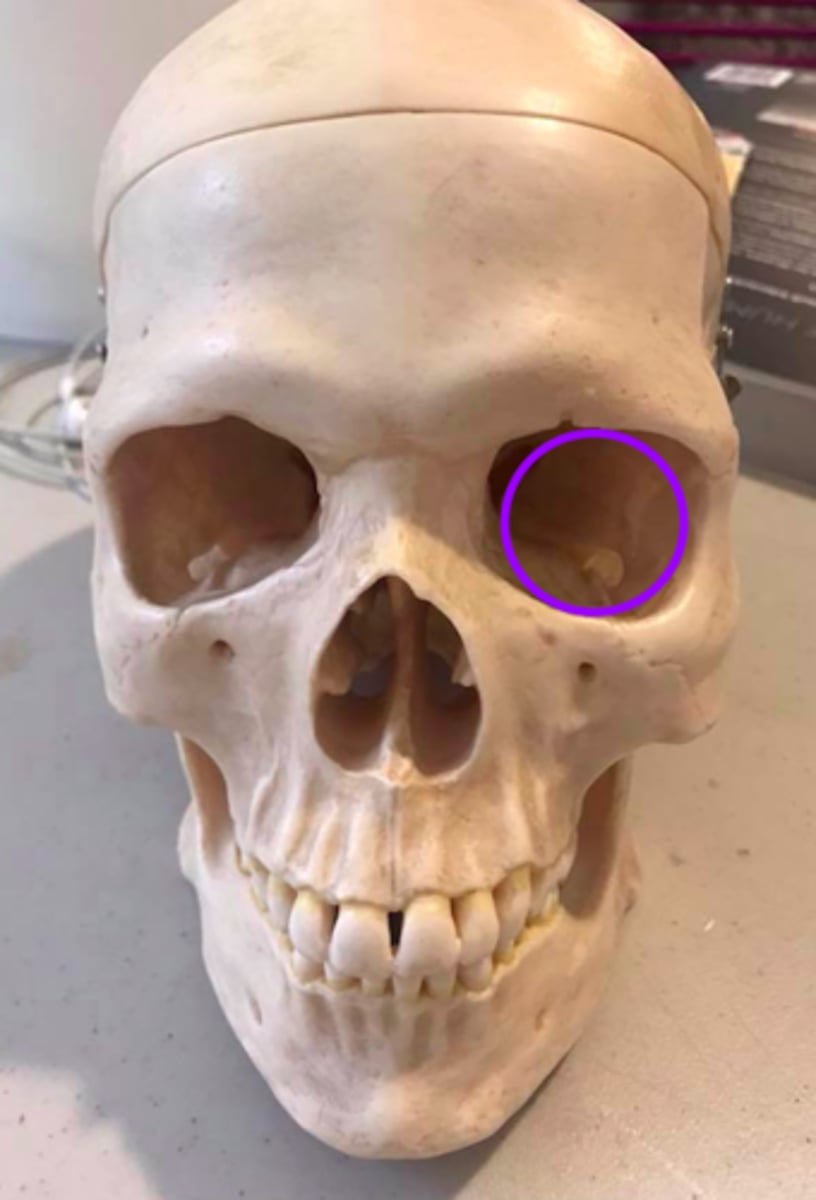 <p>What structures/features make up the orbit?</p>