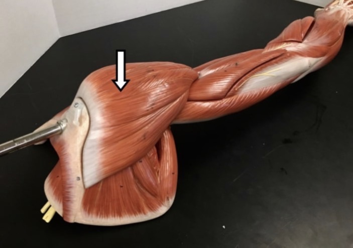 <p><span>Name the muscle labeled with the white arrow below AND name the origin</span></p>
