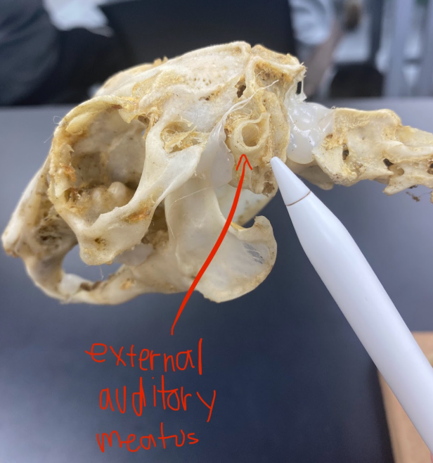 <p>External auditory meatus </p>