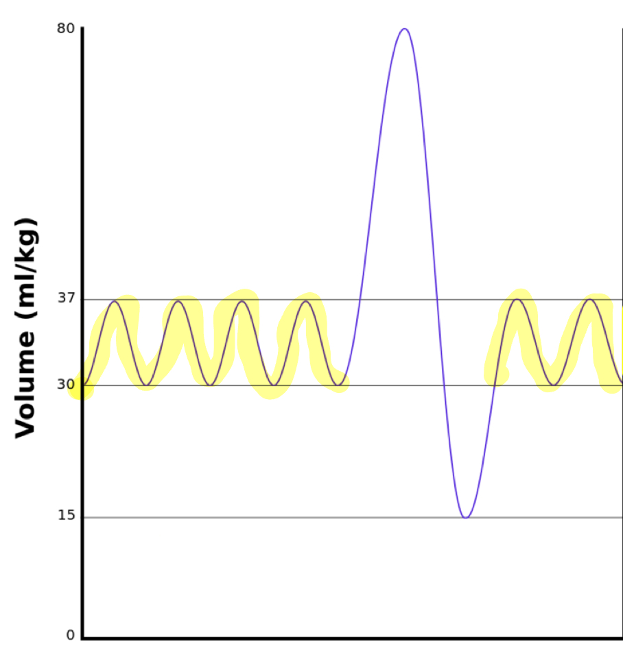 <p>volume of air moving in or out with each NORMAL breath</p>