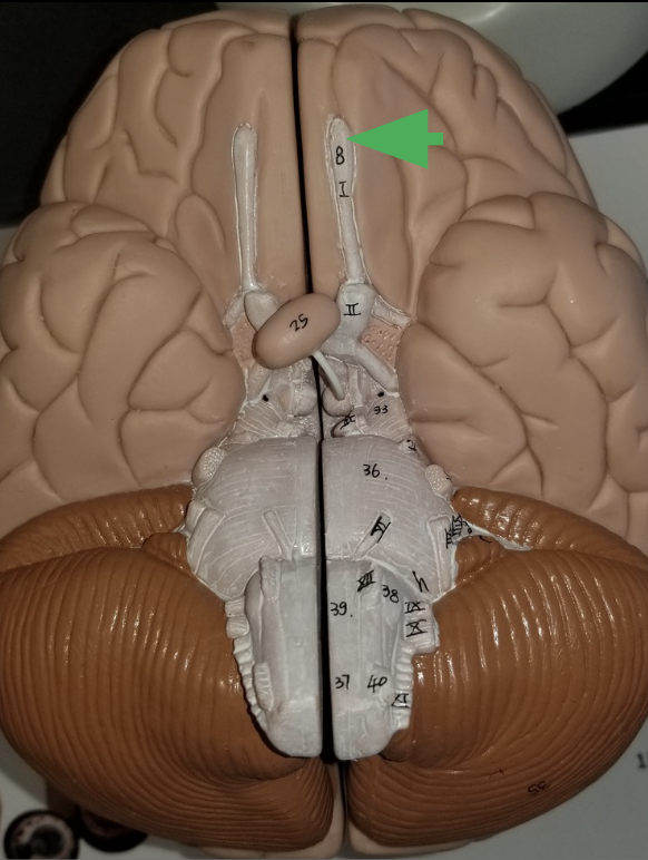 <p>what does the arrow indicate? </p>