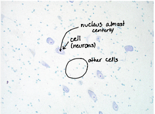 <p>Nissal bodies</p><p>staining : toluidin blue</p>