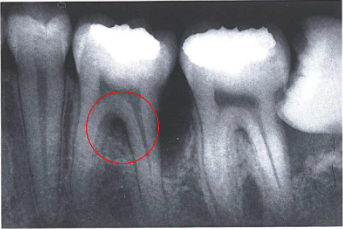 <p>describe what’s being circled </p>