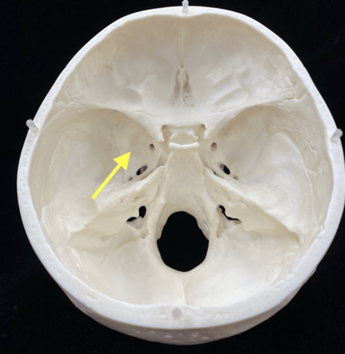 <p>name the bone </p>