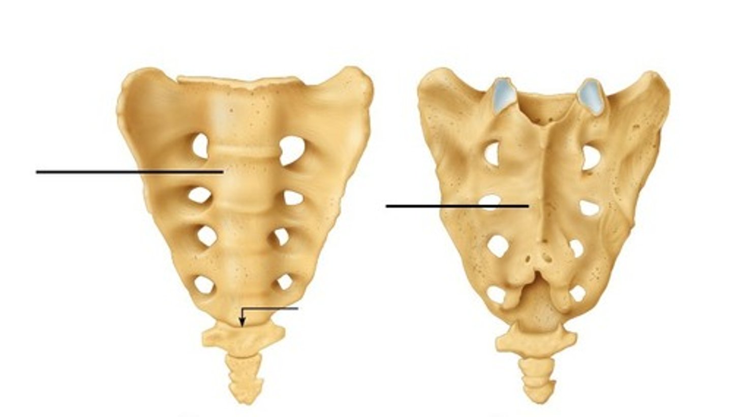 <p>Name the bone.</p>