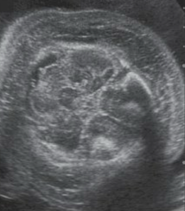 term image
