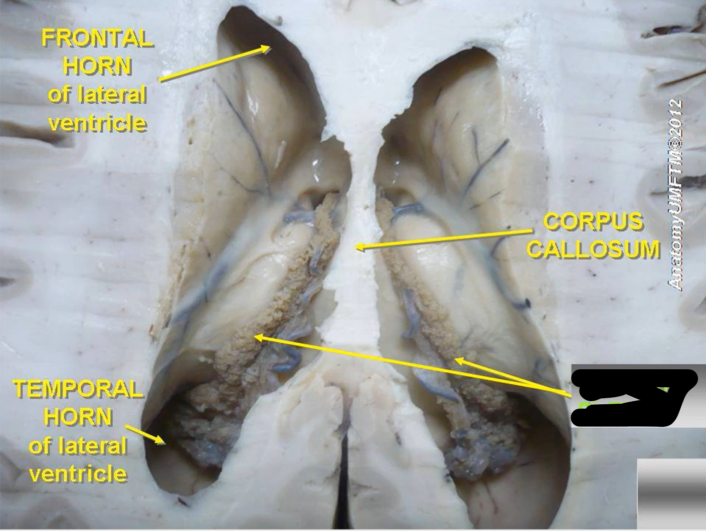 term image