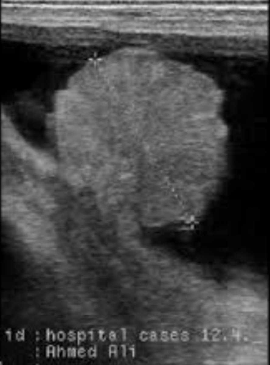 term image