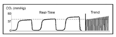 <p>You observe the following on the bedside capnograph display of a patient receiving ventilatory support. What is your interpretation of this display data?</p><p>the capnogram indicates a leak around the ET tube</p><p>the capnogram indicates hypoventilation </p><p>the capnogram indicates hyperventilation</p><p>the capnogram indicates rebreathing</p>