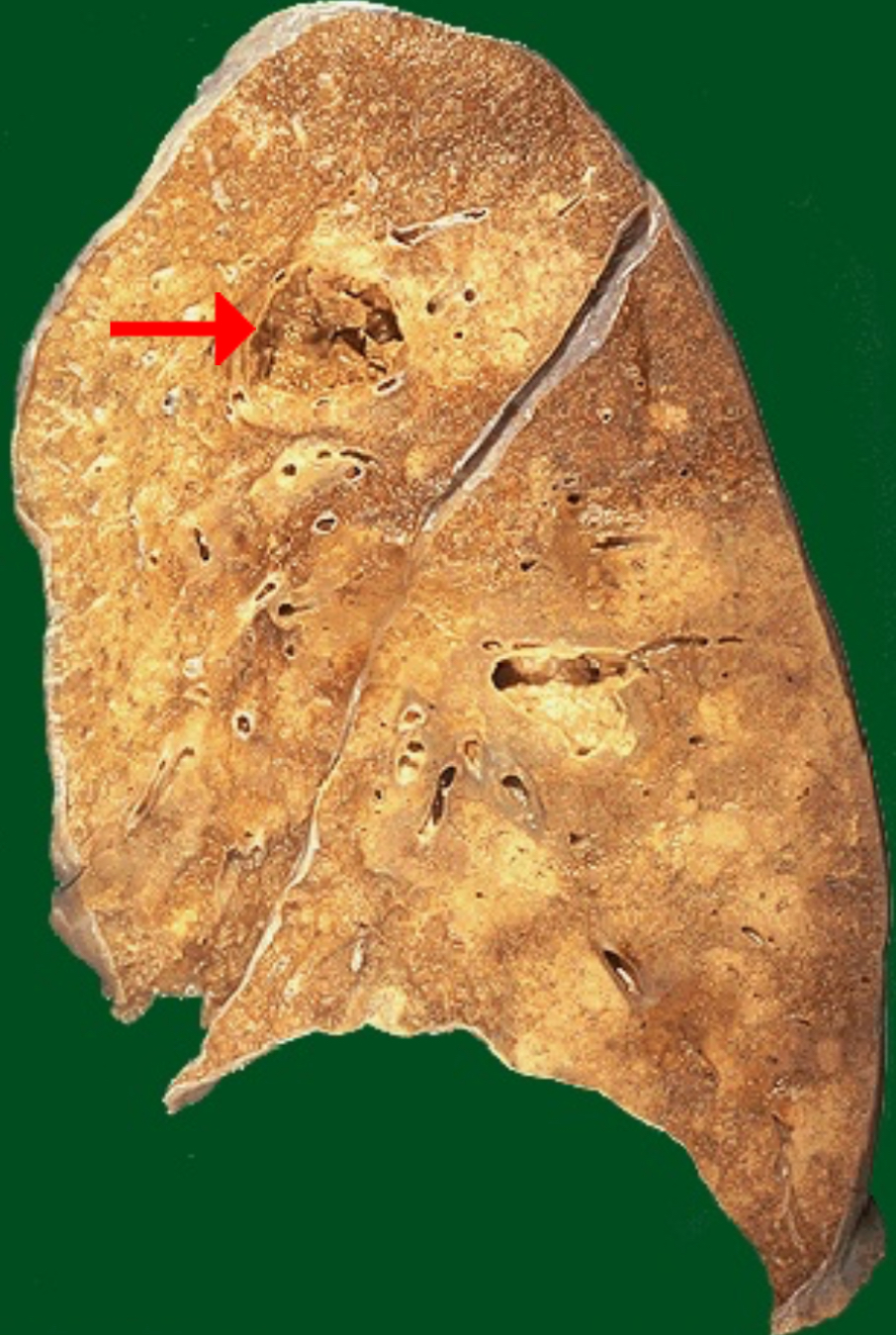 <ol><li><p>Identify morphologic pattern of acute inflammation</p><p></p></li></ol><p></p>