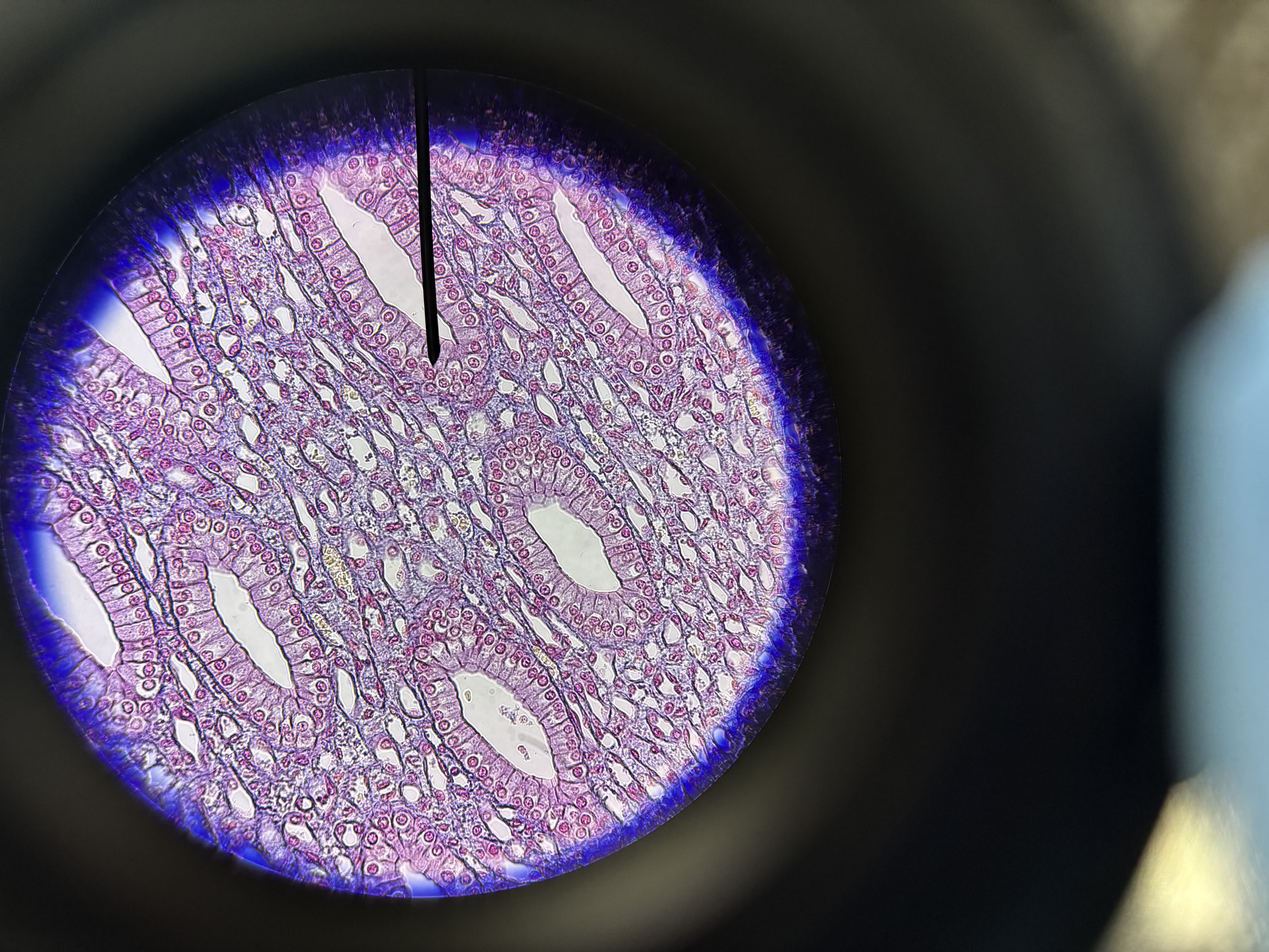 <p>Simple cuboidal epithelium</p>
