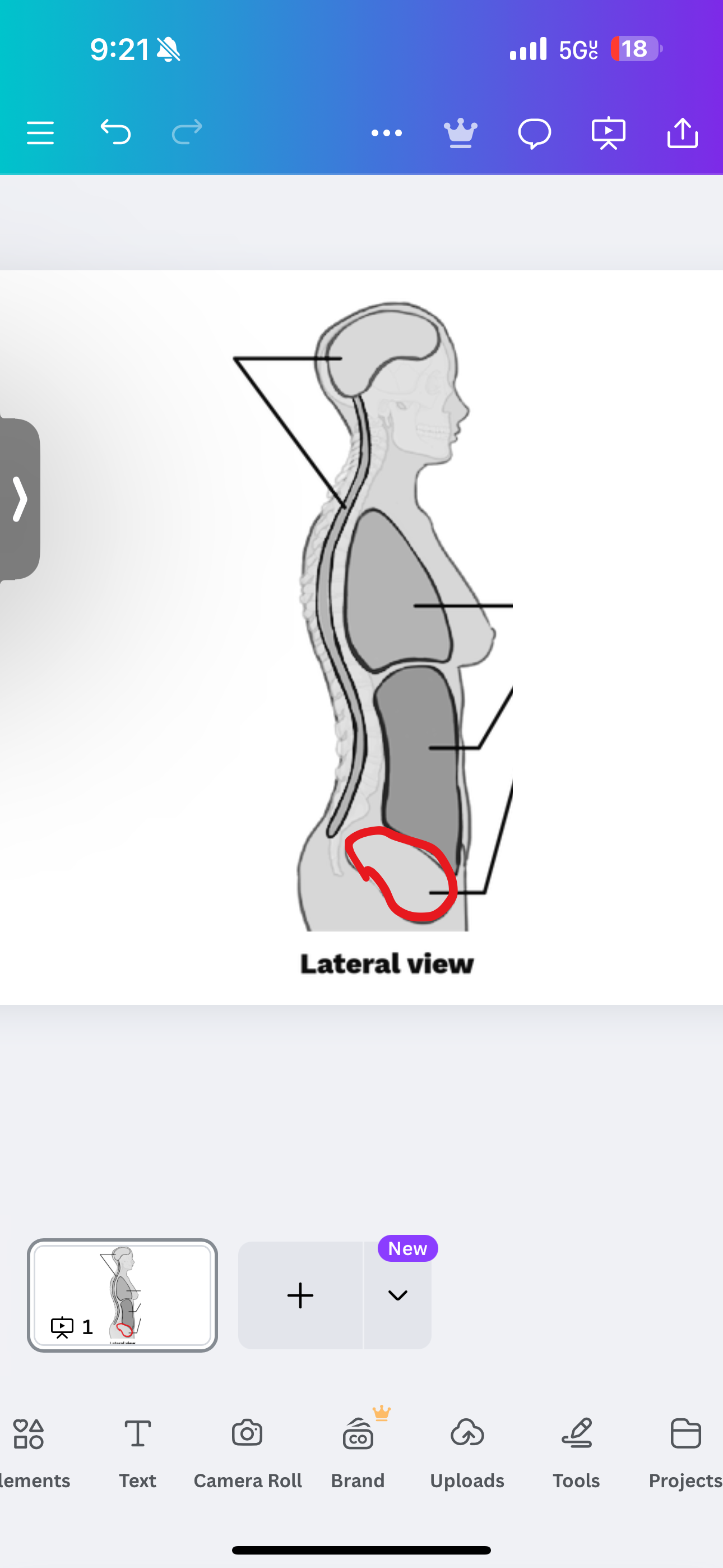 <p>What cavity is this?</p>