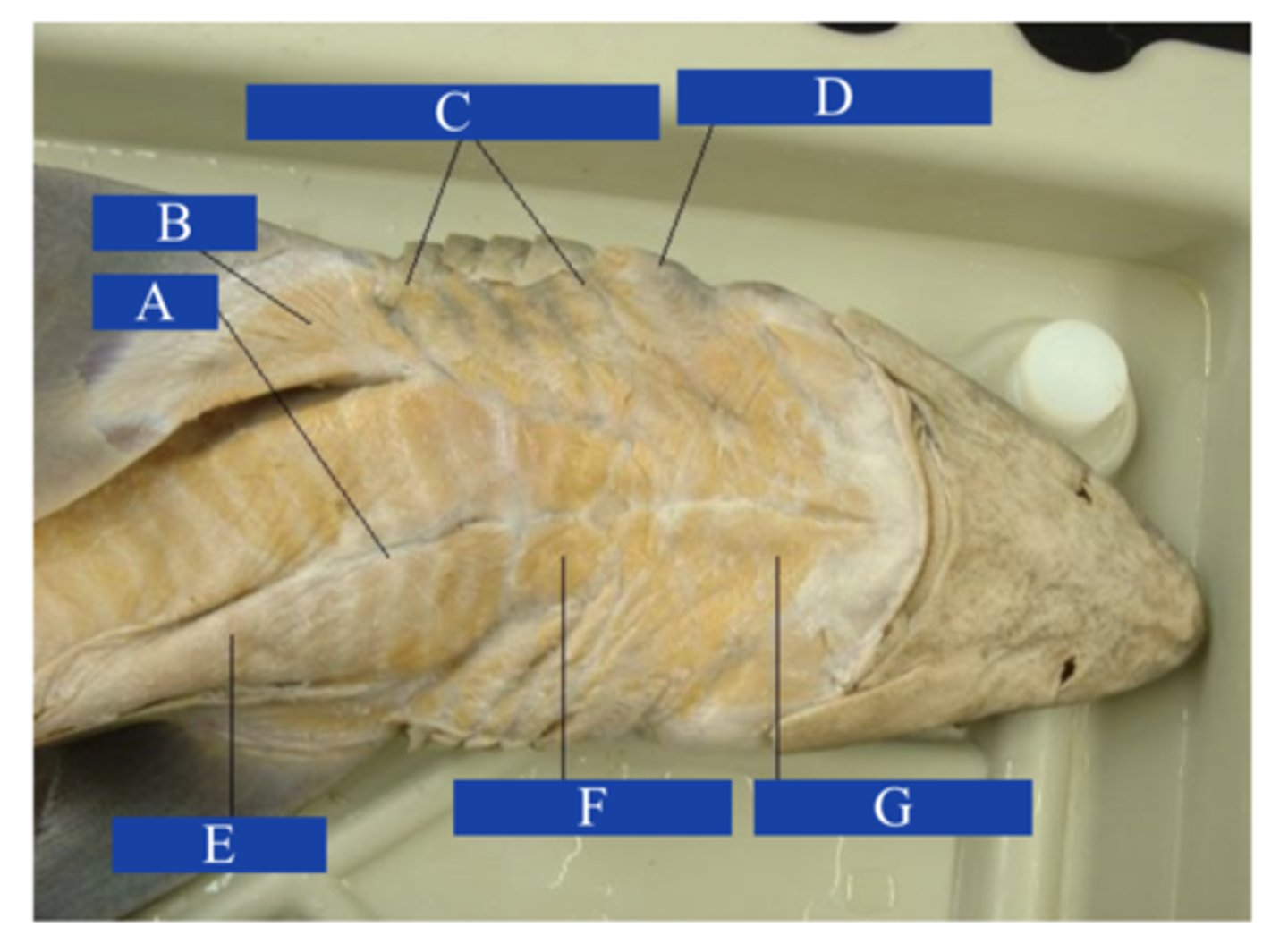 <p>What does letter B point to?</p>