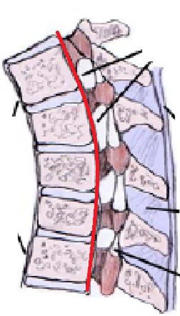 <p>This ligament sits on the posterior surface of the vertebral body in the vertebral foramen. Again it runs the entire length of the vertebral column, terminating at the sacrum and C2 vertebrae, where it extends upward to attach to the base of the skull, this is now called the TECTORIAL MEMBRANE.</p>