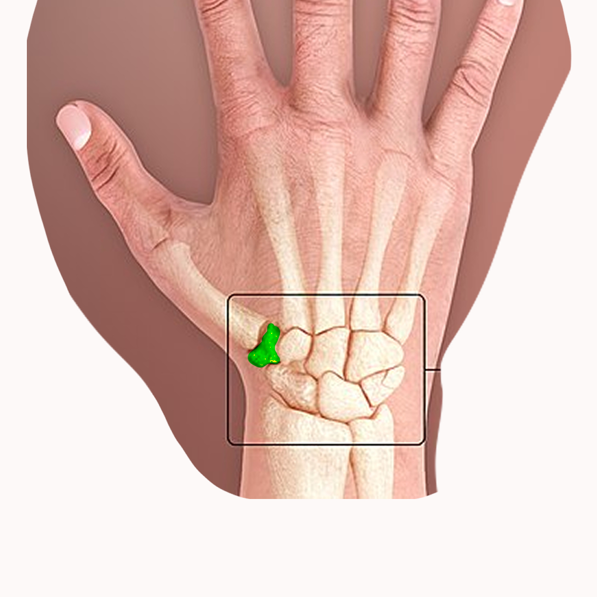 <p>Name the highlighted carpal</p>