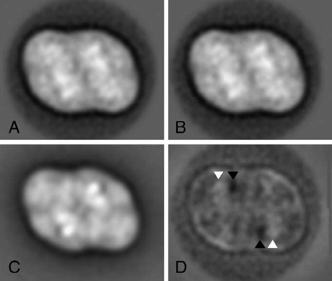 Single particle analysis