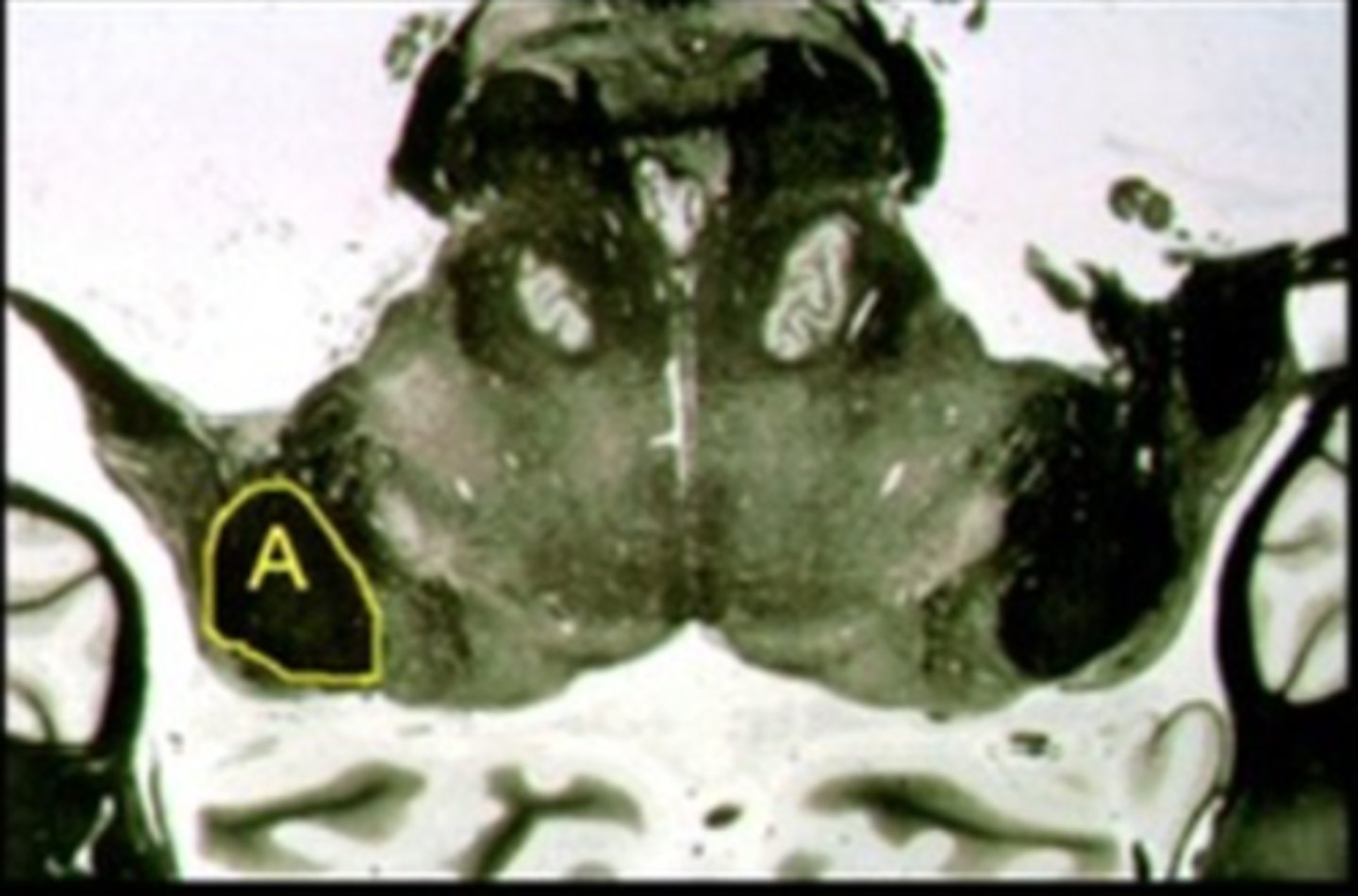 <p>Identify the structure indicated by the outline and letter "A."</p>