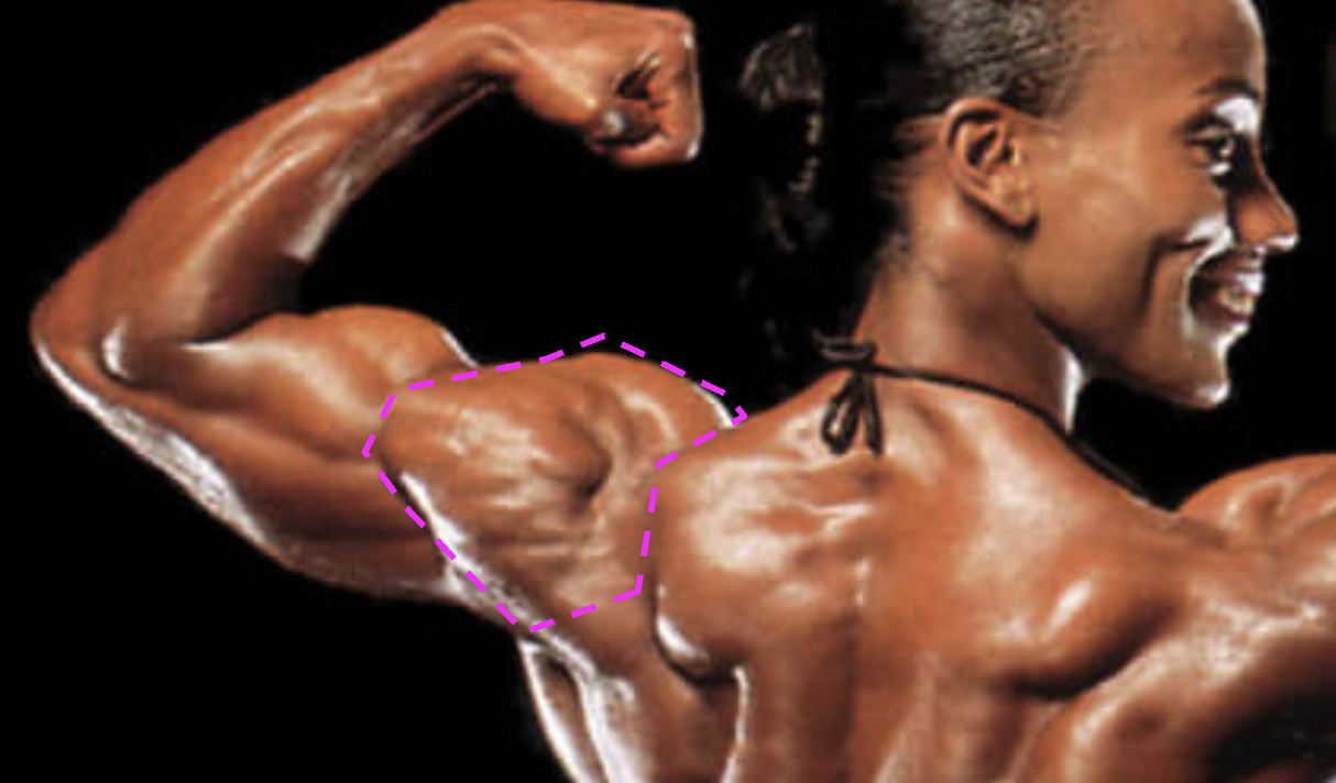 <p>What muscle is indicated by the purple region?</p>