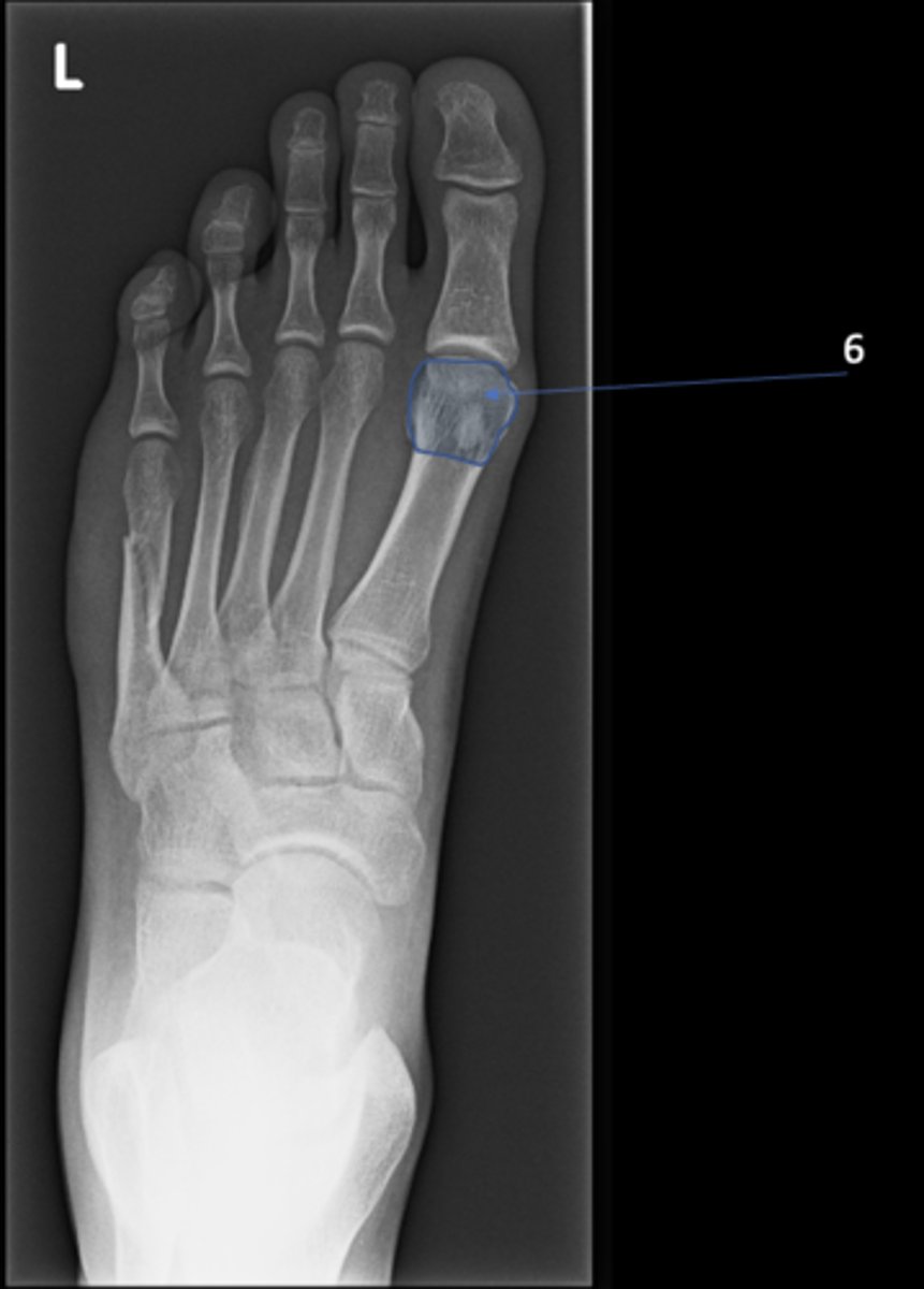 <p>ID 6</p>