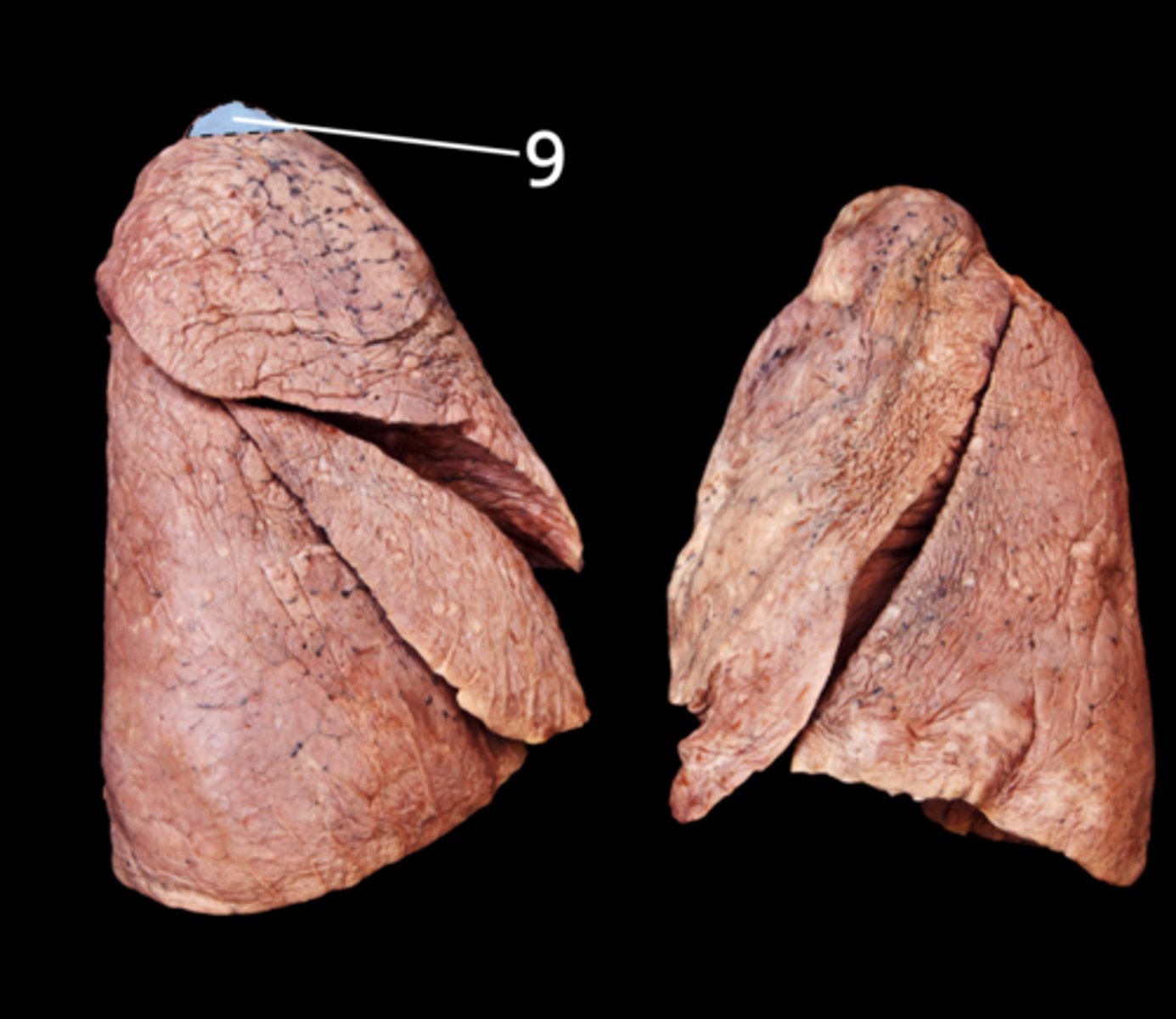 <p>Label the Lung Segment</p>