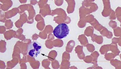 <p>what does <span style="color: rgb(254, 254, 254);"><span>A. platys cause </span></span></p>