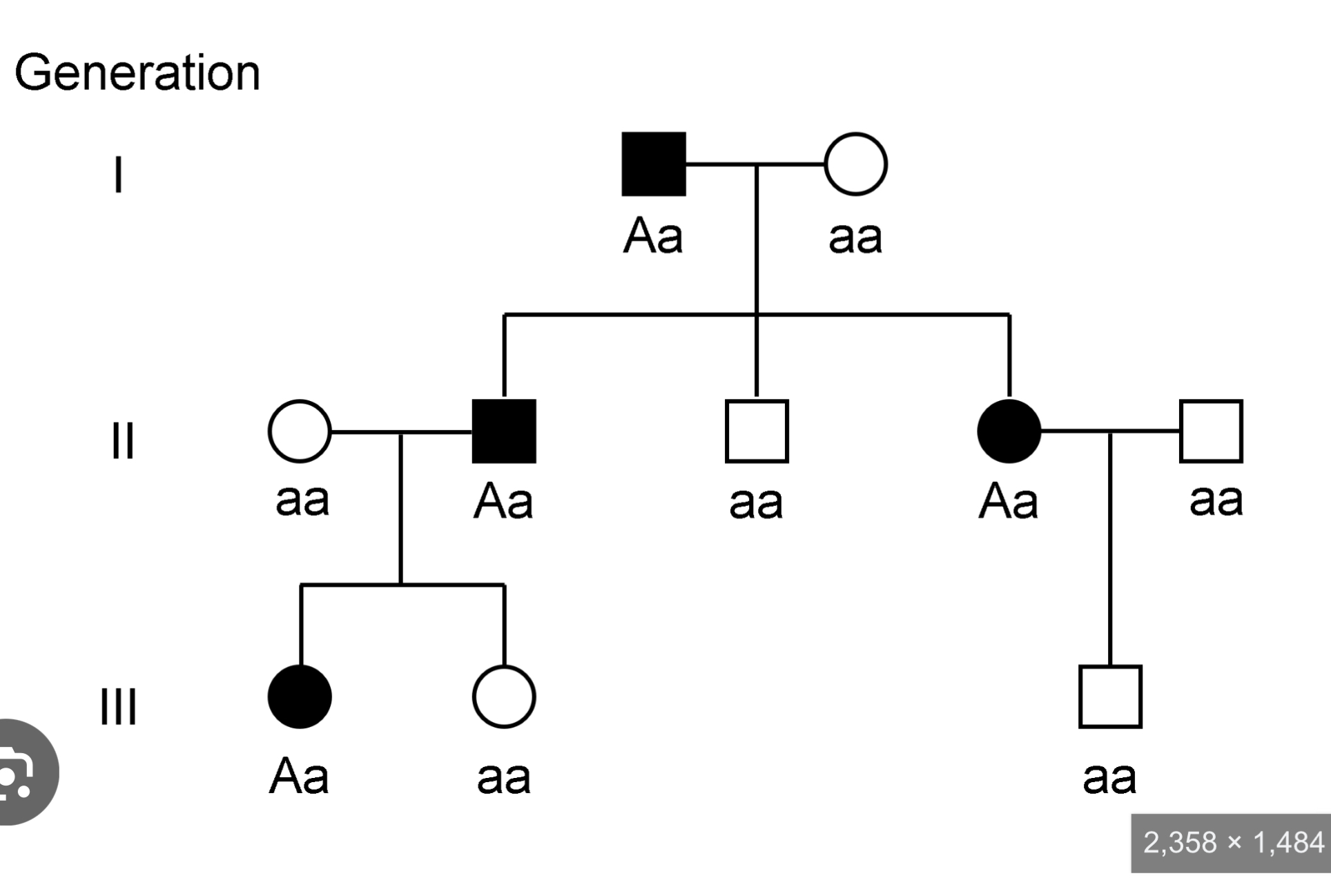 <p>^e.g. Huntington’s disease (enlargement of the frontal horns of the lateral vesicles)</p>