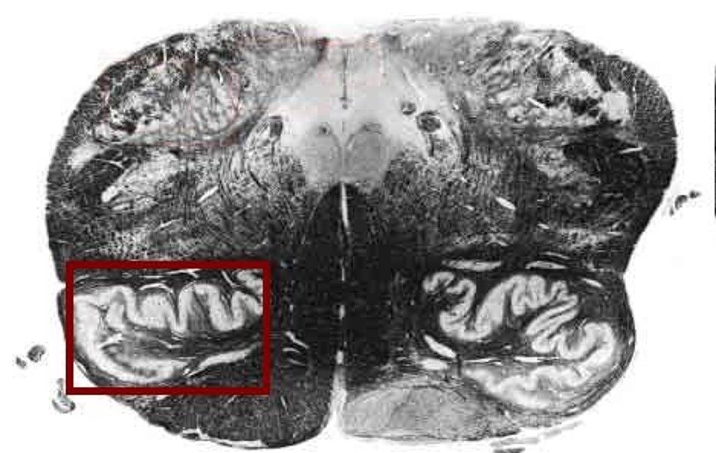 <p>-Relay center for signals to cerebellum</p>