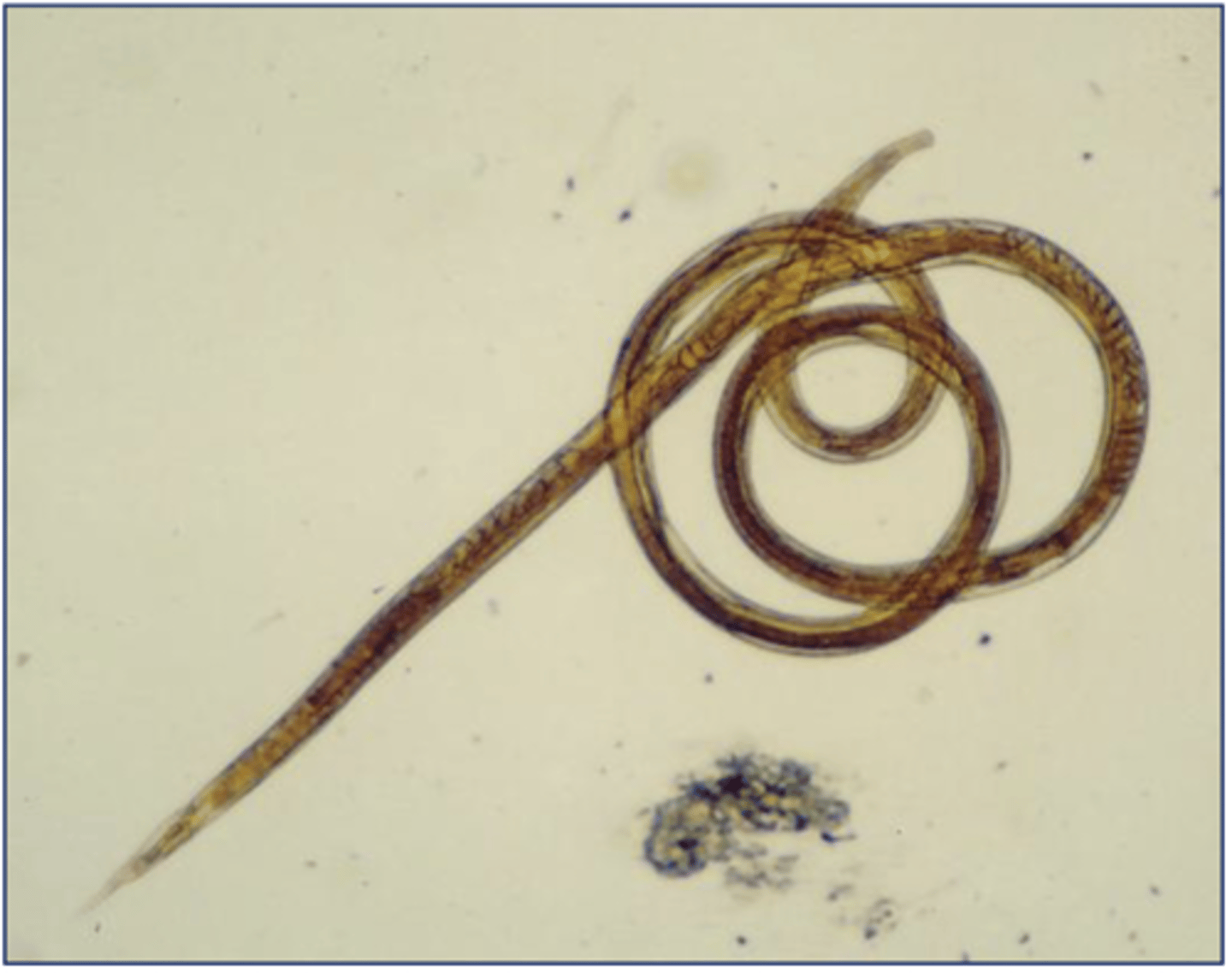 <p>What is this parasite? What characteristic/s did you use to identify it?</p>