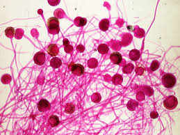 <p><span style="color: rgb(255, 253, 253);">Zygospore, sporangia</span></p><p><span style="color: rgb(255, 253, 253);">Bread and fruit mold </span></p>