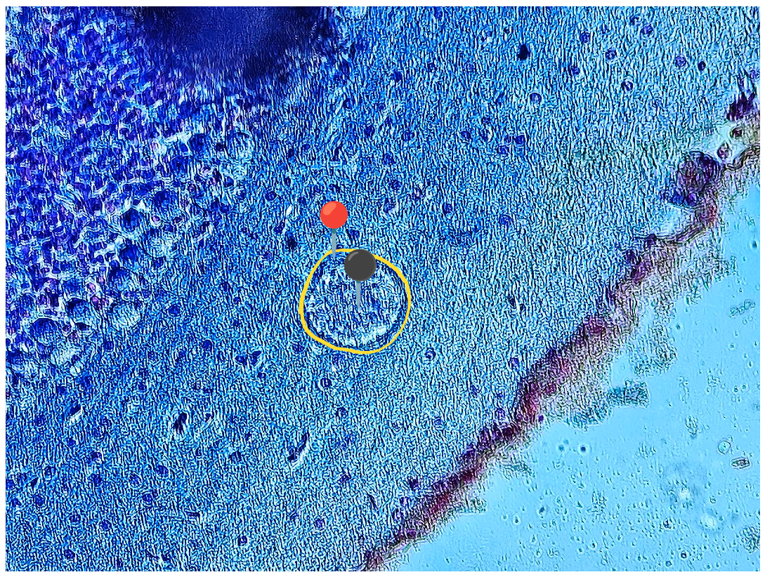 <p><strong><em>Toxoplasma gondii</em></strong></p><p>(Cysta)</p><p></p><p><strong>Organelle:</strong></p><p></p><ul><li><p><span data-name="red_circle" data-type="emoji">🔴</span> - otoczka;</p></li></ul><p></p><ul><li><p><span data-name="black_circle" data-type="emoji">⚫</span><span>️ - bradyzoity.</span></p></li></ul><p></p><p></p><p><strong>Parazytoza: </strong><em>Toksoplazmoza</em></p>