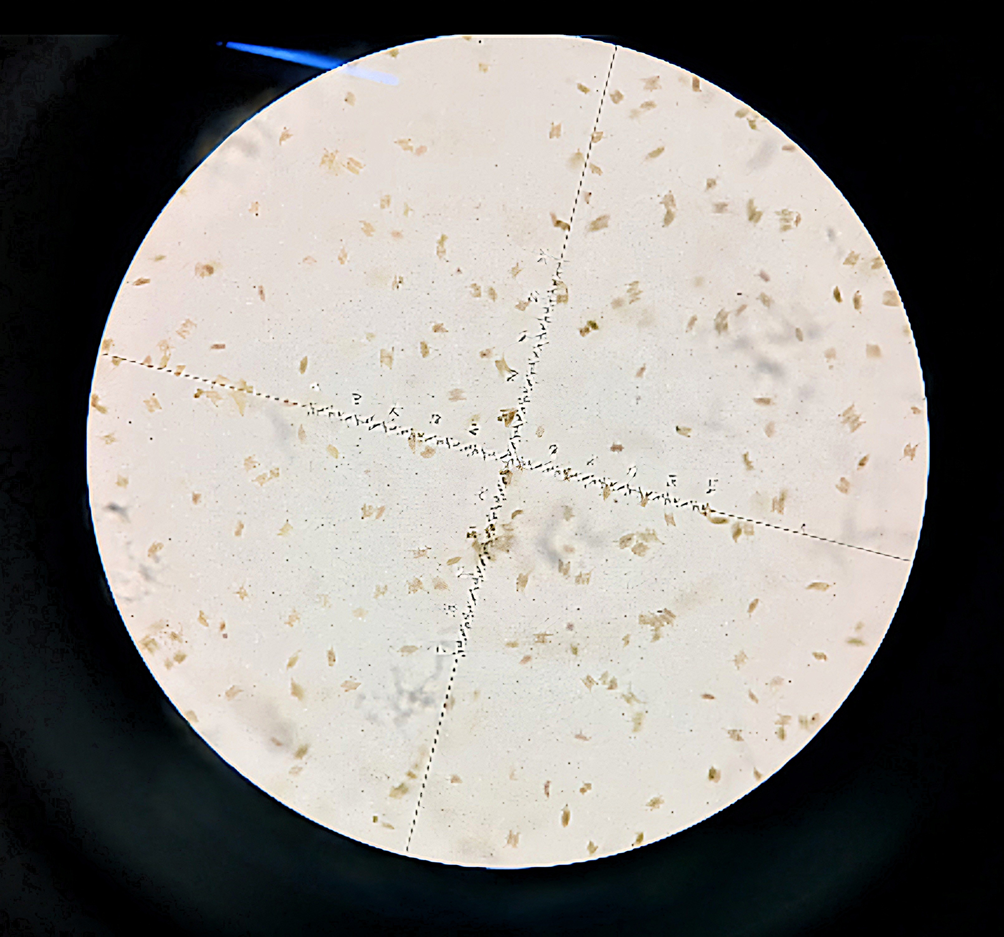 <p>Phylum: Chlorophyta</p><p>Ecological Importance:</p><ul><li><p>contributes significantly to primary production in freshwater environments.</p></li><li><p>produces oxygen, which is essential for the survival of aerobic organisms in aquatic ecosystems</p></li><li><p>plays a role in nutrient cycling by absorbing nutrients like nitrogen and phosphorus from the water.</p></li></ul><p>Economical Importance: </p><ul><li><p>has potential in biofuel production. Its high lipid content makes it suitable for producing biodiesel.</p></li><li><p>used as a feed for aquaculture, particularly for fish and crustaceans, due to its high nutritional value.</p></li><li><p>has applications in bioremediation by helping to clean up wastewater.</p></li></ul><p></p>