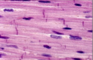 <p>only cover walls of the heart; branched, intercalated discs.</p>