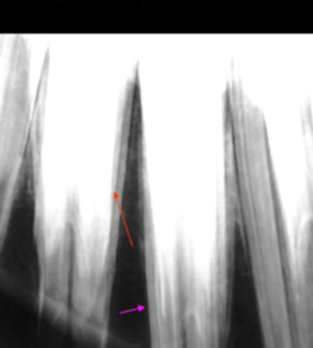 <p>What is the pink arrow pointing at</p>