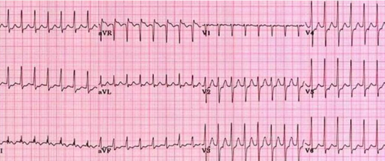 <p>what is this?</p>