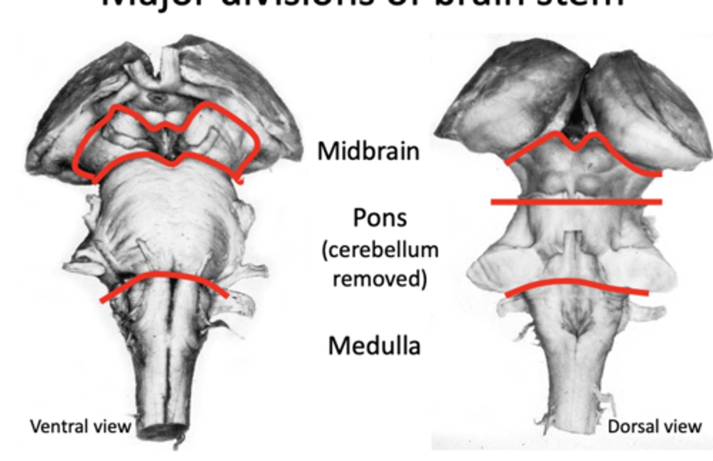 <p>- Rostral half of medulla (top half) is covered by part of the 4th ventricle</p>
