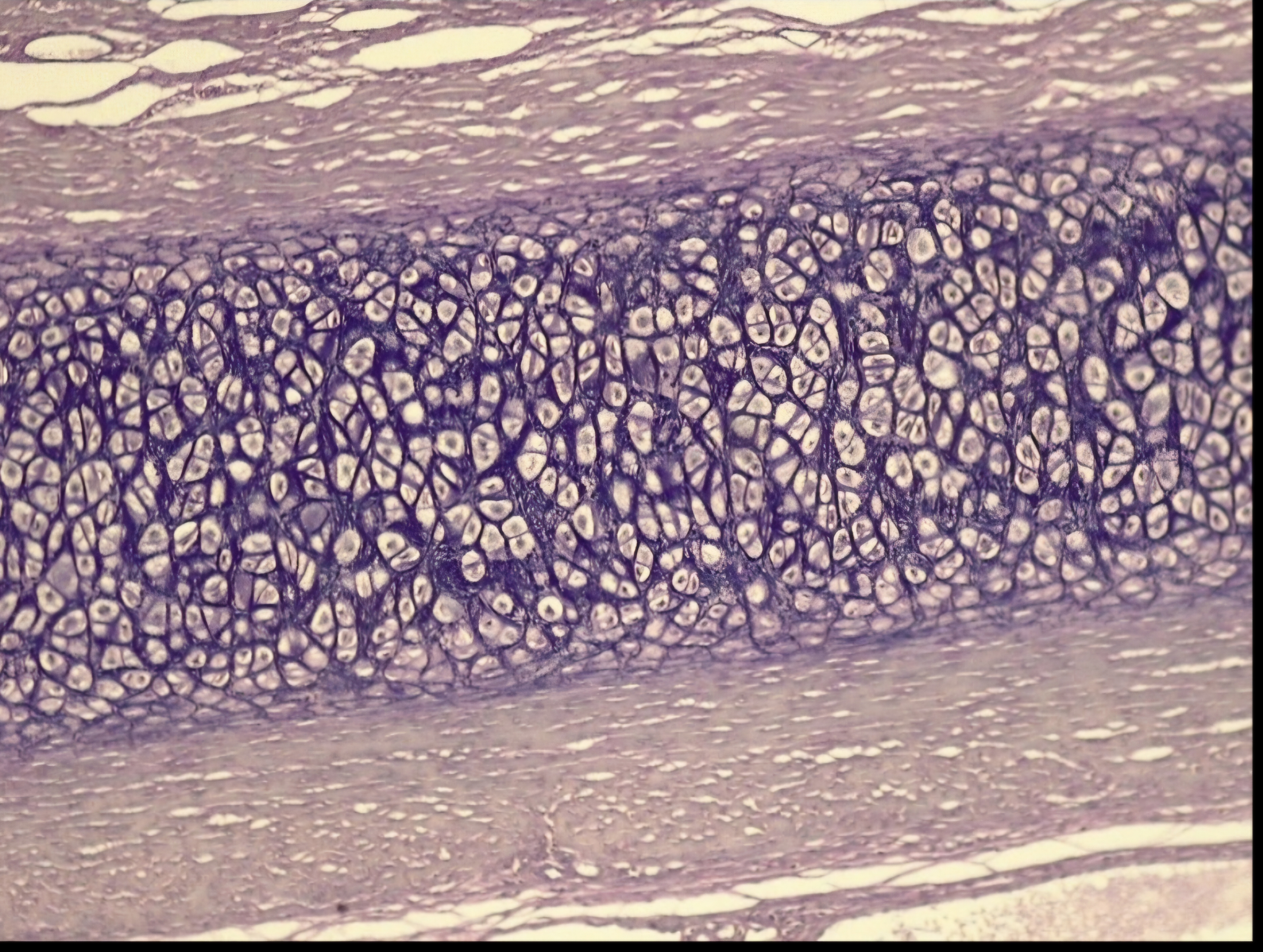 <p>Elastic cartilage</p>