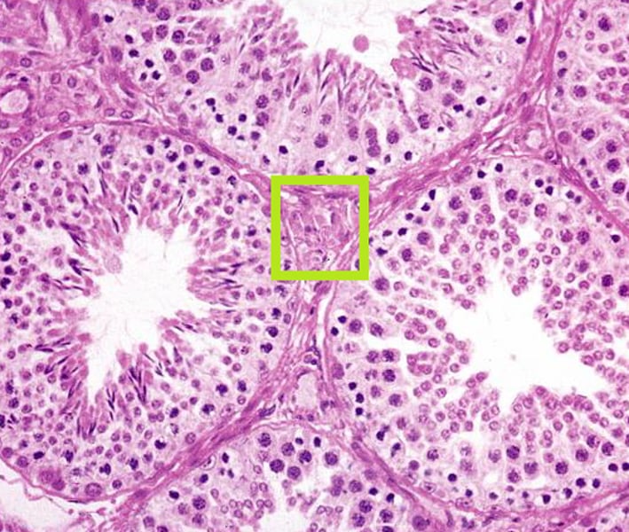 <p>Lies between seminiferous tubules</p><p>Produce testosterone. Influenced by LH from the pituitary</p>