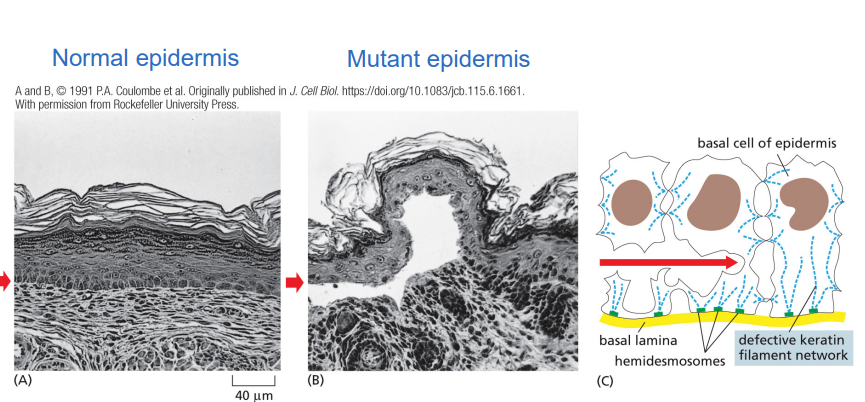 <p>the epidermis is prone to tear and blister in response to mechanical stress</p><p></p>