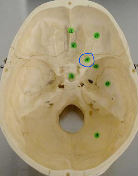 <p>#14 (internal skull)</p>