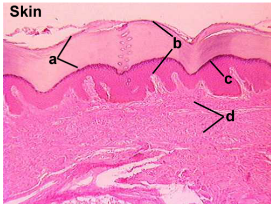 <p>a. Identify epithelial layer </p><p>b. Identify type of epithelium </p><p>c. Identify dark stained layer of epithelium </p><p>d. Identify layer</p>