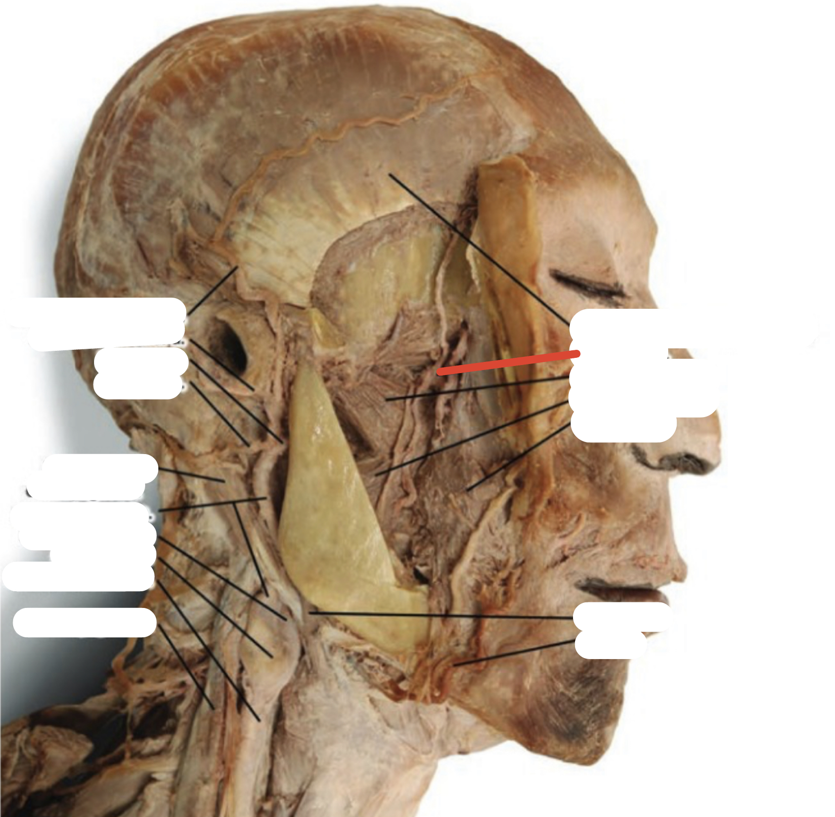 Identify the structure (red line)