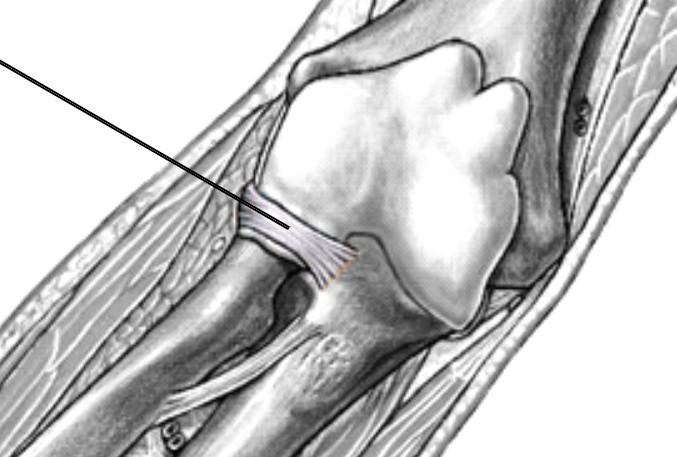 <p>Which ligament of the elbow is:</p><ul><li><p>Start and end at ulna</p></li><li><p>Wraps around radius</p></li></ul><p></p>