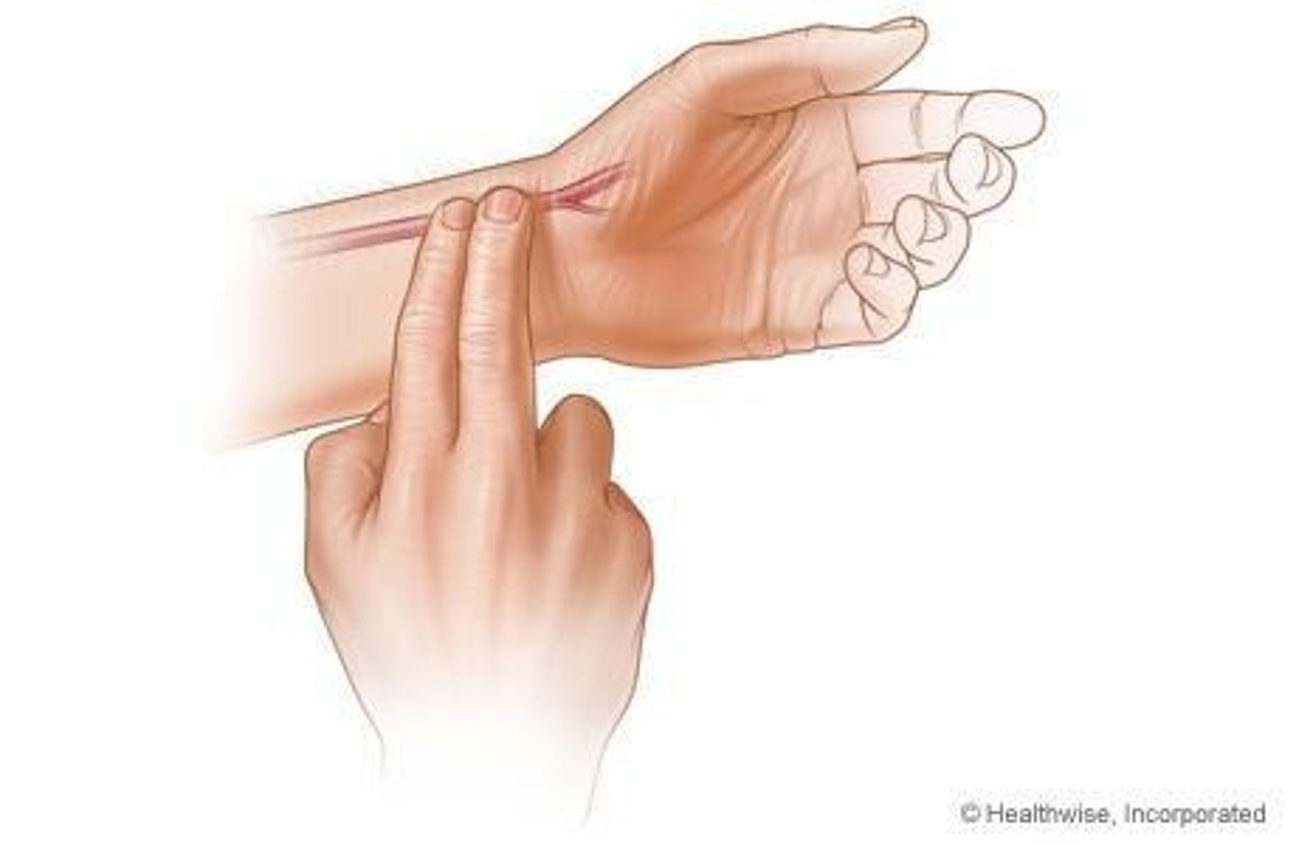 <p>The pulse felt at the wrist, used to assess heart rate and rhythm.</p>