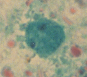 term image