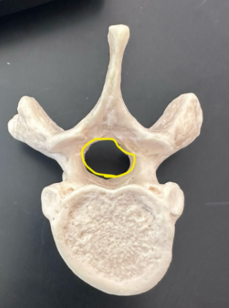 <p>What is circled in yellow?</p>