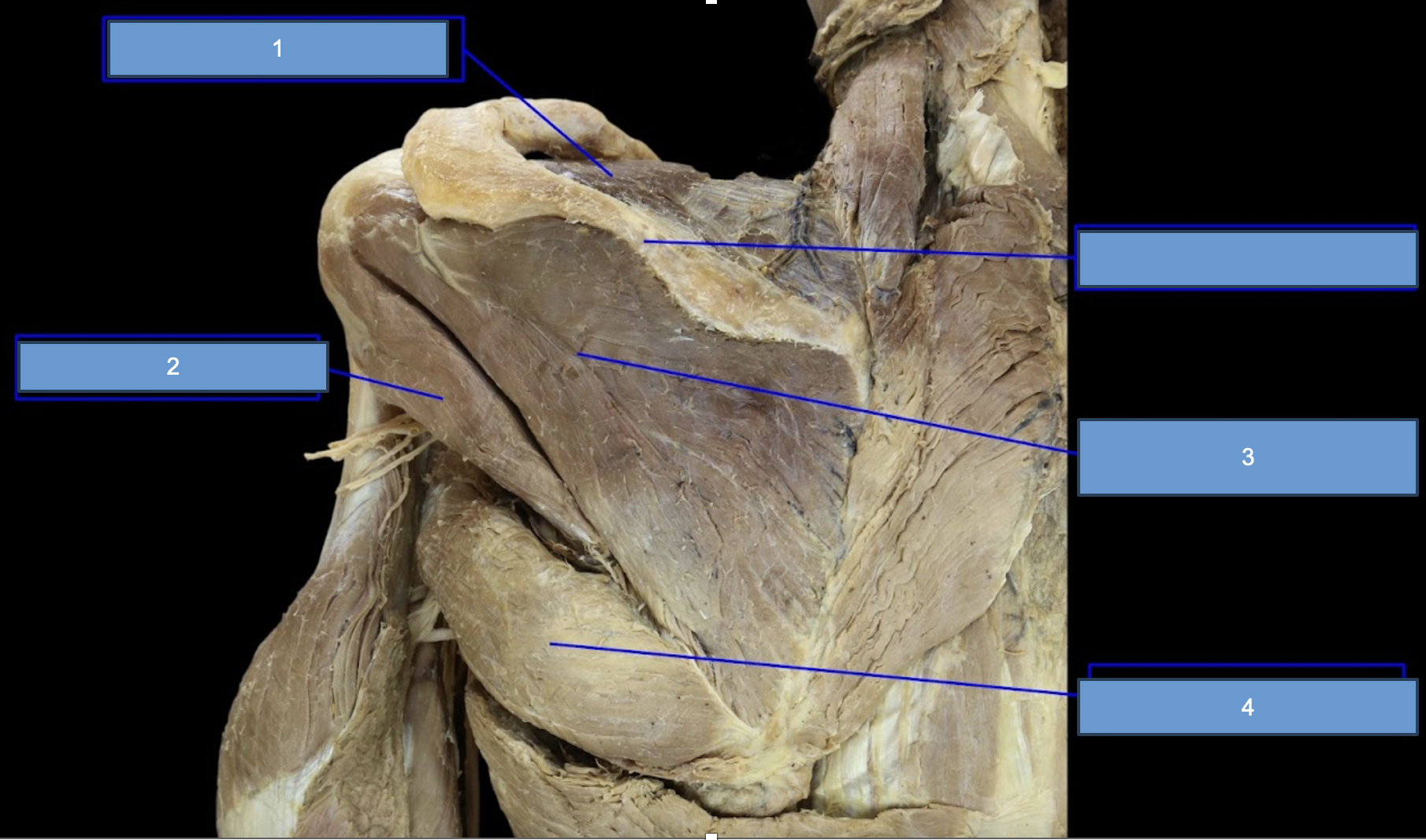 <p>1; where are all these muscles located?</p>