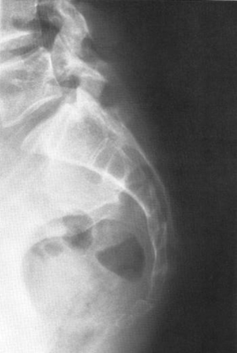 <p>ID view</p>