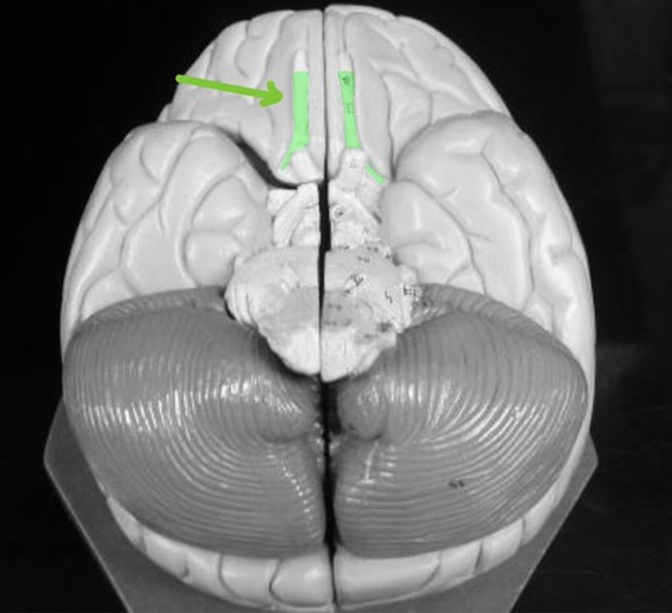 <p>Transmits OLFACTORTY (smell) information to the brain.</p>