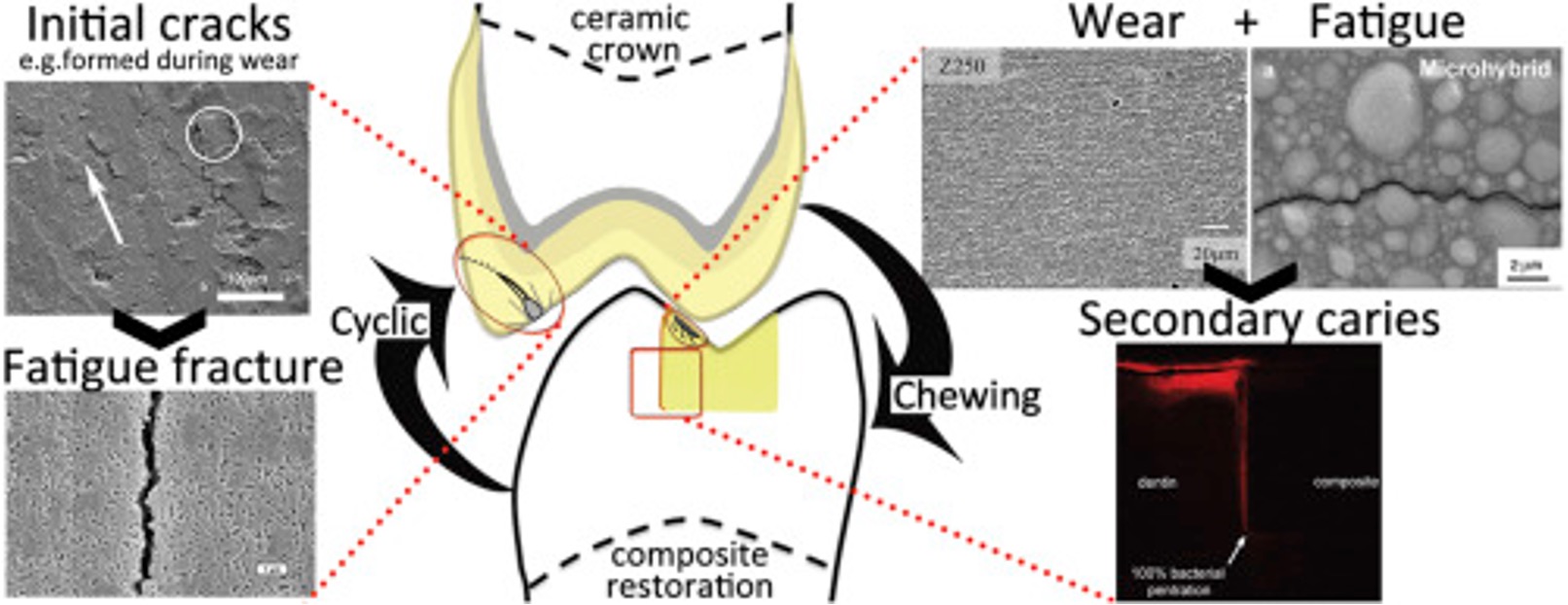 <p>By adding a high proportion of crystalline phase-  resist crack propagation via-&nbsp;</p><p><strong>Weak grain interfaces</strong> in single-phase ceramics due to incomplete sintering</p><p><strong>Residual strains</strong> in two-phase ceramics from mismatch between crystals and glass matrix</p>