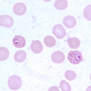 <p>(left)</p>